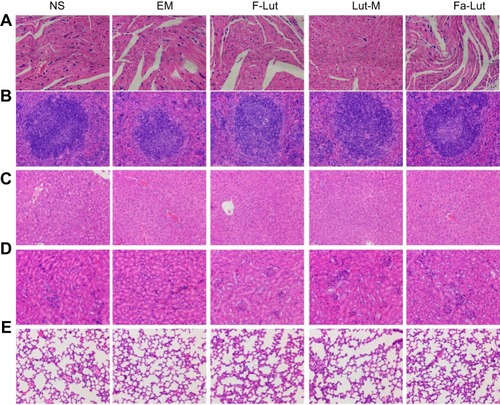 Figure 13 In vivo toxicity assessment and histological images. The vital organs (heart (A), spleen (B), liver (C), kidney (D) and lung (E)) were collected from the mice and histologically examined under a microscope using HE staining. All groups showed normal histomorphology.