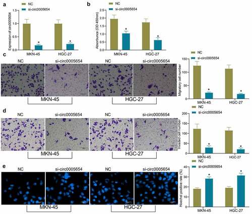 Figure 2. Circ0005654 suppresses the proliferation and aggressiveness of GC cells. A, circ0005654 expression after circ0005654 knockdown measured by RT-qPCR; B, OD values of cells after inhibition of circ0005654 assessed by CCK8; C, cell migration activity after inhibition of circ0005654 examined by Transwell assay; D, cell invasion activity after inhibition of circ0005654 examined by Transwell assay; E, cell apoptosis after inhibition of circ0005654 evaluated by Hoechst staining. Values are shown as the mean ± SD based on three independent experiments. *p < 0.05 vs cells transfected with NC. Experimental results were analyzed using two-way ANOVA followed by Tukey’s test