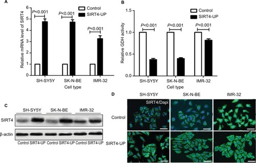 Figure 3 Establishment of stable cell expression of SIRT4.Notes: (A) Expression of SIRT4 mRNA in control and neuroblastoma cells (SH-SY5Y, SK-N-BE, and IMR-32) overexpressing SIRT4 as shown by real-time fluorescence quantitative PCR; (B) glutamate dehydrogenase (GDH) activity in control and cells overexpressing SIRT4; (C, D) expression of SIRT4 protein in control and cells overexpressing SIRT4 as shown by Western blot and immunofluorescence. Each experiment was repeated at least three independent times. Scale bar =50 µm. “UP” indicates the gene expression of SIRT4 was up-regulated.