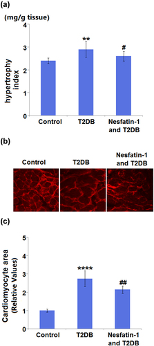 Figure 4. Protective effects of Nesfatin-1 on myocardial hypertrophy in type 2 diabetes (T2DB) mice. (a) Hypertrophy index; (b) Images of wheat germ agglutinin (WGA) staining in the cardiomyocyte cross-sectional area; (c) Quantification analysis of Cardiomyocyte area (****, P < 0.0001 vs. vehicle group; ## P < 0.01 vs. streptozotocin (STZ) mice).