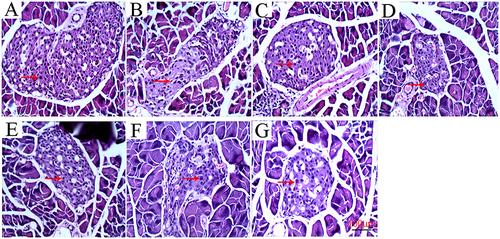 Figure 4 Histopathology of pancreatic tissue in mice of each group (HE 200X). The arrows show the islets of the pancreas. (A) NC group; (B) Pio group; (C) DM group; (D) FCLE-500 group; (E) FCLE-1000 group; (F) FCLP-500 group; (G) FCLP-1000 group.