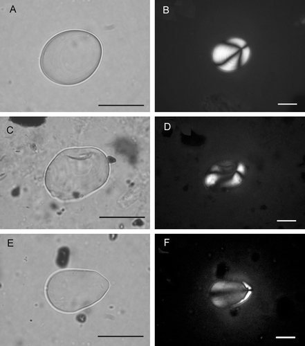 Fig. 1  Ancient starch from Vao Island [mounted in glycerol jelly; transmitted or cross-polarized light (CPL), the latter with black background; 600×and 400×; (B), (D) and (F) shown at lower magnification to increase light contrast because the Maltese cross on ancient grains is often faded; scale bars: 20 m]. (A–D) Starch grains consistent with Dioscorea nummularia tuber (cf. Fig. 2A–D). (B) and (D) shown in CPL with eccentric Maltese cross. (E,F) Starch grain consistent with Dioscorea pentaphylla tuber from sample L II (cf. Fig. 2E,F). (F) Shown in CPL with eccentric Maltese cross.