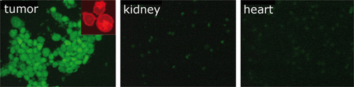 Figure 5. Fluorescence micrographs of tumour, kidney and heart cells; fluorescently labelled stabilised 5% Pluronic micelles were injected intravenously into the A2780 ovarian carcinoma bearing mouse; 4 h after the injection, tumour was sonicated for 30 s by 1 MHz ultrasound at a 3.4 W/cm2 power density. The insert is a confocal image of the cultured tumour cells incubated with a 50 mg/mL fluorescently labelled Pluronic P-105 solution showing that Pluronic molecules were localised in cell membranes and cytoplasmic vesicles but did not penetrate into the nuclei of ovarian carcinoma cells. Adapted from Gao et al. Citation[82] with permission from ACS Publishing.