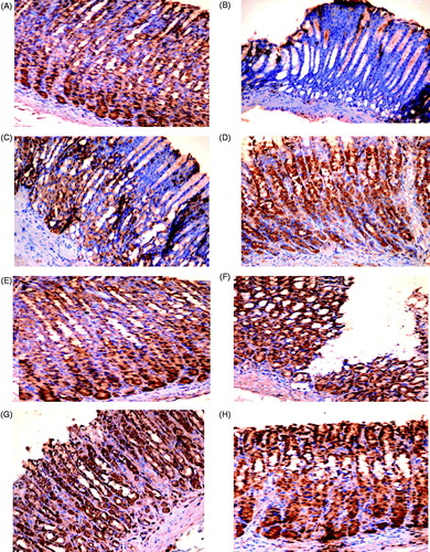 Figure 3. COX-2 expression in rat gastric mucosa. (A, E) Highly positive (+++) expression of COX-2 in gastric mucosa of Control groups 1 and 2 rats, respectively. (B) Negative (±) expression in INDO rat. (C) Moderate positive (++) expression in ranitidine + INDO rat. (D) Highly positive (+++) expression in fluoxetine + INDO rat. (F) Highly positive (+++) expression around the rim of the ulcer in alcohol-only rat. (G) Highly positive (+++) expression around remaining ulceration in ranitidine + alcohol rat. (H) Highly positive (+++) expression in fluoxetine + alcohol rat. Representative photomicrographs from each group are shown (PAP; magnification = 40×).