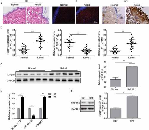 Figure 1. HOXA11-AS and TGFβR1 are up-regulated, while miR-124-3p is down-regulated in keloid tissues or fibroblasts