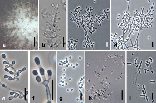 Fig. 6. Sigleria amenda. Ex-type culture on MEA. A. Sporodochial and aerial conidiophores. B–F. Conidiophores and conidia. G, H. Terminal and single lateral conidia and arthroconidia. I. arthroconidia. Bars: A = 500 μm, B–J = 10 μm.