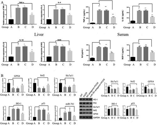 Figure 4. Serum and liver markers of inflammation (A) and ferroptosis (B) showing the existence of ferroptosis and inflammation. Ctrl group (A), NC-mimic group (B), NC-antagomir + PCOS group (C) and miR-761-antagomir + PCOS group (D). *p < .05; **p < .01.