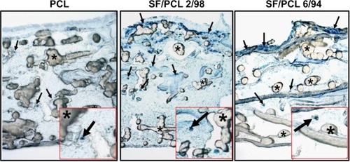 Figure 8 Hematoxylin-stained cross-sectional images of PCL 100, SF/PCL 2/98, and SF/PCL 6/94 nano/microfibrous composite scaffolds after 5 days of human mesenchymal stem cell (hMSC) culturing.Notes: Arrows and asterisks indicate the penetrating hMSCs and PCL microfibers, respectively. Original magnification 100×.Abbreviations: PCL, poly(ε-caprolactone); SF, silk fibroin.