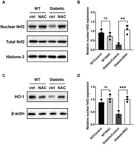 Figure 3. NAC activates Nrf2/HO-1 signaling pathway in pregnant GDM mice.
