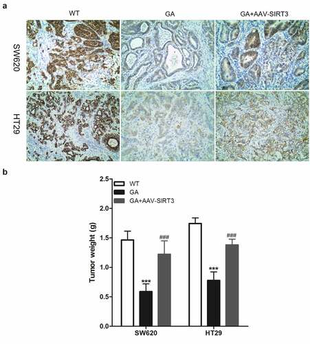 Figure 7. Glycyrrhizic acid inhibits SITR3 expression and the proliferation of colorectal cancer cells in nude mouse. (a-b) Subcutaneous injection of colorectal cancer cells to establish xenograft tumor models in nude mice. 3 weeks later, nude mice were euthanized, xenograft tumors were isolated, SIRT3 protein expression was detected by immunohistochemistry (a), and xenograft tumors were weighed for comparison (b). 8 mice per group. *** P < 0.001 vs WT group, and ### P < 0.001 vs 20 μM GA group.