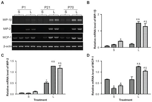 Figure 6 Relative mRNA expression of chemokines in the lung of P1, P21, and P70 animals. P1, P21, and P70 animals were treated with saline (S) or 0.25 mg/kg lipopolysaccharide (L) for 2 hours. Relative mRNA levels of MIP-1β (A and B), MIP-2 (A and C), and MCP-1 (A and D) in the lung of these animals were measured by semiquantitative reverse transcription PCR.