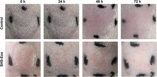Figure 6 Skin irritation response of guinea pigs to the combination of hucMSC-Exos Exos (150 μL, 1 mg/mL) and SHSs over 72 h.