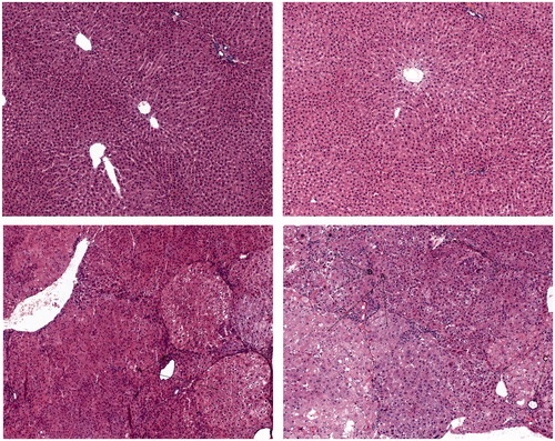 Figure 1. Representative images (×100) of liver sections (haematoxylin and eosin staining). I Control rat. Normal liver architecture. Representative images (×100) of liver sections (haematoxylin and eosin staining). II Rat treated with yellow tea alone. Normal liver structure. Representative images (×100) of liver sections (haematoxylin and eosin staining). III Rat treated with NDEA alone. Pathological liver structure: (A) dysplastic nodule or early hepatocellular carcinoma. Representative images (×100) of liver sections (haematoxylin and eosin staining). IV Rat treated with yellow tea + NDEA. Pathological liver structure: (A) dysplastic nodule, (B) intrahepatic cholestasis and © extrahepatic cholestasis.