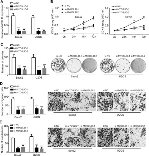 Figure 2 Effects of MYOSLID on proliferation, migration and invasion. (A) Relative expression of MYOSLID in Saos2 and U2OS cells. (B, C) CCK8 assay and colony formation assay were performed to measure proliferation. (D, E) MYOSLID knockdown inhibited migration and invasion by Transwell assay. **P<0.01 and ***P<0.001.