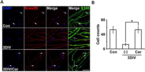 Figure 4. Inhibition of TRPM7 maintains Schwann cell differentiation in ex vivo sciatic nerves. (A) Sciatic nerve fibers were immunostained with anti-S100 (green), anti-Krox20 (red) and DAPI (blue). Arrows mean Krox20/DAPI double-positive cells. Scale bar = 50 μm. (B) Cell counts were the number of Krox20/DAPI double-positive cells per 200 DAPI cells (n = 3).