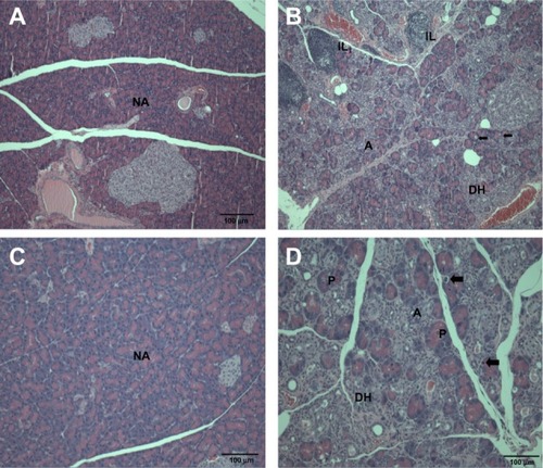 Figure 5 Histopathological changes in the pancreas after treatment with (A and B) ZnOAE100(−) and (C and D) ZnOAE100(+) at a dose of 500 mg/kg for 90 days. The pancreas sections were stained with hematoxylin and eosin. (A and C) Control for acinar cell. (B and D) 500 mg/kg treatment groups.aNotes: aArrows in (B and D) represent acinar cell apoptosis in the pancreas.Abbreviations: A, chronic inflammation; DH, ductular hyperplasia; IL, interstitial lymphoid cell infiltration; NA, normal acinar cell; P, prominent acinar cell; ZnO, zinc oxide; ZnOAE100(−), 100 nm negatively charged ZnO; ZnOAE100(+), 100 nm positively charged ZnO.
