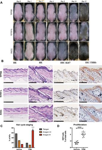 Figure 1 (A) Photographs of dorsal skins of C3H mice on the timepoint of Day 0, Day 1, Day 2, Day 4, Day 8, Day 14, Day 21 of the blank, vehicle and TDM treatment groups, respectively. The dorsal skin color of the TDM group turned grey on Day 4 and darker on Day 8 with hair shaft growing, compared with the other 2 groups. (B) H&E, Thyroid hormone receptor beta-1 and Ki-67 immunohistology images of the dorsal skin on the mice treated with blank control, vehicle control and TDM10842 at the timepoint of Day 2. The hair bulb of the TDM group was enlarged than the other 2 groups and expanded into the subcutaneous tissue at the section from the H&E perspective (as shown with the arrow). There was no significant difference of expression for thyroid hormone receptor beta-1 between the 3 groups. The expression of Ki-67 was increased in the follicular tissue of TDM group. (C) Results of microscopic hair cycle staging of two groups. Ratios of telogen, anagen I–II and anagen IIIa hair follicles were calculated in each group. Data are mean standard error of the mean of the two groups. Data are means±SD,****p < 0.0001, n=9. (D) The expression of Ki-67 was increased in the follicular tissue of TDM group. Data are means±SD,****p < 0.0001, n=9.