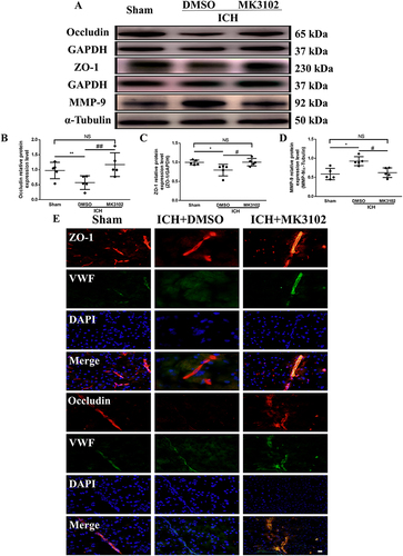 Figure 5 MK3102 prevented the change of MMP-9, ZO-1 and Occludin induced by ICH in mice. (A) Representative Western blot bands of MMP-9, ZO-1 and Occludin. (B–D) Quantitative analyses of relative protein expression level of MMP-9, ZO-1 and Occludin at 3 days after ICH. n = 5 per group. (E) Representative microphotographs of immunofluorescence co-localization staining for BBB tight junction protein ZO-1 and Occludin with vWF in the perihematomal area 3 days after ICH. Scale bar, 20 μm. All data are displayed as mean ± SD. The difference between groups was analyzed using One-way ANOVA test. *p<0.05, **p<0.01, compared with sham group. #p<0.05, ##p<0.01, compared with the ICH + DMSO group.