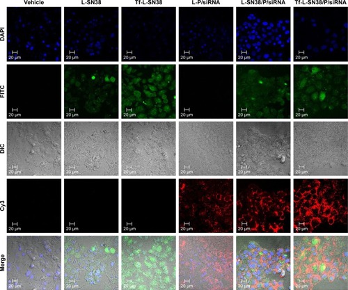 Figure 6 Cellular uptake of liposome preparations.Notes: FITC- and Cy3-labeled series of liposome preparations were incubated with HeLa cells for 4 hours. Empty (unlabeled) liposomes were used as the control. The internalization was observed by a confocal microscope.Abbreviation: DIC, differential interfering contrast.