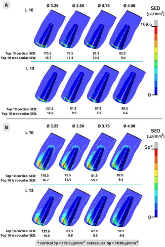 Figure 3. Strain energy density (SED) distribution and mean of top 10 SED for cortical and trabecular buccal bone. A: using the same color range adjustment for cortical and trabecular bone. B: using specific color range adjustments for cortical and trabecular bone, according to each bone SED pathologic resorption limit (Sp) value (109.6 µJ/mm3 for cortical and 10.96 µJ/mm3 for trabecular bone).