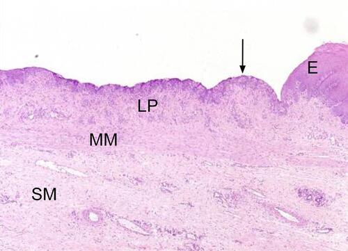 Figure 5 Erosion (black arrow) adjacent to normal squamous epithelium. Bar = 1000 μm. Notice the dramatic thinning of the affected epithelium. Image reproduced with permission of Equine Veterinary Journal. Martineau H, Thompson H, Taylor D. Pathology of gastritis and gastric ulceration in the horse. Part 1: range of lesions present in 21 mature individuals. Equine Vet J. 2009;41(7):638–644.Citation23