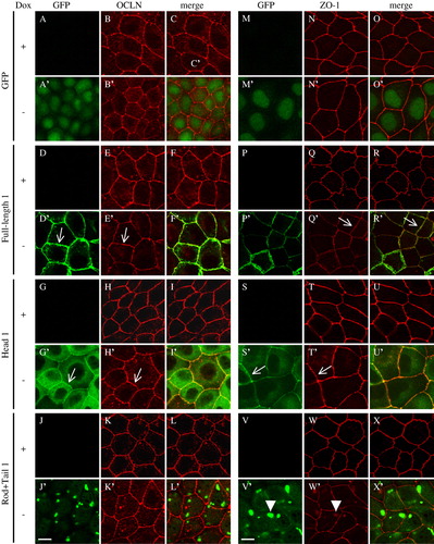 Figure 5.  Effect of cingulin overexpression on the localization of occludin and ZO-1 in MDCK cells. Immunofluorescent localization of GFP, GFP fused to full-length canine cingulin, head, or rod + tail domains (green), occludin and ZO-1 (red), either in the presence (+) or absence (−) of Dox. Merge images show co-localization. Single arrows (D′, E′, G′, H′, Q′, R′, S′, T′) indicate junctional labeling. Arrowheads (V′, W′) indicate cytoplasmic labeling. Images are representative of two independent experiments. Bar = 10 µm. This figure is reproduced in colour in Molecular Membrane Biology online.