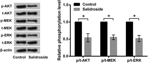 Figure 4. Salidroside deactivated AKT and the MEK/ERK signal pathway in A549 cells. A549 cells were stimulated with salidroside (800 μM) for 48 h, and non-treated cells acted as control. Phosphorylation levels of AKT, MEK and ERK were determined by western blot. Data are presented as the mean ± SD of at least three independent experiments. *p < .05.