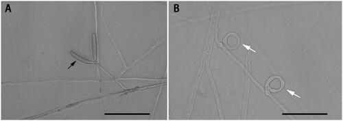 Figure 1. Species reference image of Drechslerella dactyloides. (A) The hypha and conidia (black arrow). (B) The constricting rings (white arrow) for capturing nematodes. Bar = 50 μm. These photographs were taken in this study.