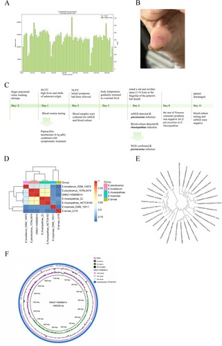 Figure 1. The diagnosis of E. piscisicarius infection and the genome analysis. (A) The whole genome sequencing yielded a total genome coverage of 91.2%. (B) Red and swollen mass on the patient's left thumb fingertip with a size of about 1 × 0.5 cm. (C) The timeline of the clinical course of the patient. (D) ANI heatmap showed that DNK211006EB014 shared an ANI greater than 0.95 with E. piscisicarius_15TAL0474. (E) E. piscisicarius is identified by phylogenetic analysis. (F) Circular map of the genome.