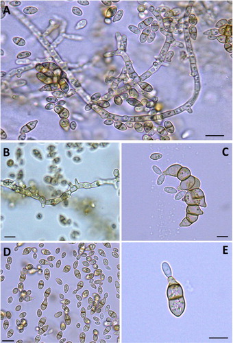 Figure 2. H. werneckii in 3-week-old culture. Different shapes of budding conidia and pseudomycelium (A–E).Note: Bright-field light micrographs (mounted in water). Scale bars: 0.5 µm (A–D), 0.1 µm (E).