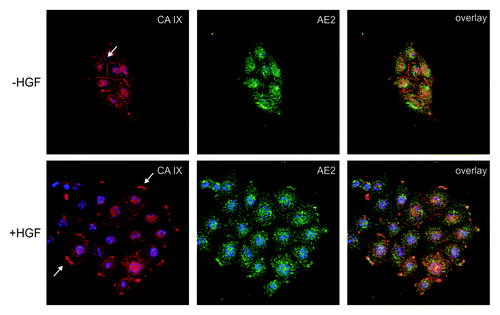 Figure 1. Co-localization of CA IX with AE2 in SiHa cervical carcinoma cells. The cells were grown in islands and exposed to hypoxia for 48 h. Then they were stimulated to migration with HGF (+ HGF) or left un-stimulated (− HGF), double-stained for CA IX (red) and AE2 (green) and subjected to confocal microscopic analysis. In absence of HGF, CA IX was present in the plasma membrane regions involved in intercellular connections, whereas the contact-free membranes were devoid of this protein. Punctate cytoplasmic staining represents precursor forms of CA IX as well as AE2. In HGF stimulated cells, both CA IX and AE2 underwent re-localization to the newly formed lamellipodia in accordance with their coordinated functional involvement in pH control at the protruding membranes of the migrating cells.