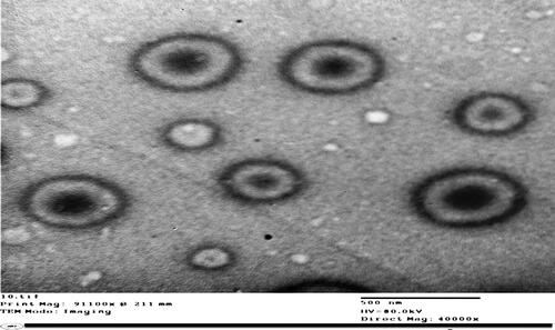 Figure 3 Transmission electron micrograph of the optimized ethosomal RP formulation.