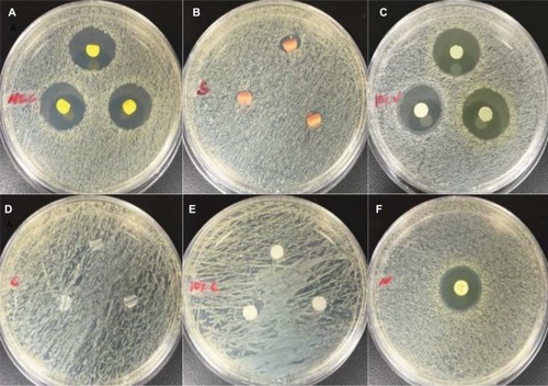 Figure 10 Images of Mueller–Hinton agar disc diffusion assay against Staphylococcus aureus at 24 hours. (A) antibacterial catheter, (B) silver-coated catheter, (C) PDMS–HNT–PEO–nitrofurantoin, (D) 100% PDMS catheter, (E) PDMS–HNT–PEO, and (F) standard nitrofurantoin disc (100 mg).