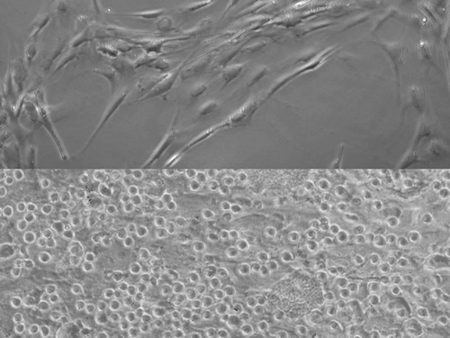 Figure 1 The most used adult stem cell sources in clinical trials have been skeletal myoblasts(top) and mononuclear bone marrow (bottom) stem cells.