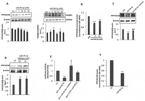 Figure 3. miR-98-5p downregulates PPP1R15B levels in HaCaT cells. (a) HaCaT cells transfected with either the scramble (Scr) or miR-98-5p were lysed after 48 h and 50 ug of lysate was subjected for western blot analysis using anti-PPP1R15B and anti-TGFβR1 antibodies. β-actin and GAPDH were used as the loading control. Densitometric analysis of the blots is given below the respective blots. (b) Total RNA was isolated from cells incubated as in (a) and the mRNA levels of the PPP1R15B were quantified using qRT-PCR and normalized to the levels of 18S rRNA. (c) HaCaT cells were transfected with either the scramble or the miR-98-5p mimic alone or with its inhibitor (75 nM) and after 48 h of incubation, lysates were probed for the protein levels of PPP1R15B. β-actin was taken as the loading control. (d) HaCaT cells were transfected with the scramble (Scr) or the miR-98-5p inhibitor (50, 75 nM) and after 48 h, the levels of PPP1R15B were analysed by Western Blot analyses. β-actin was taken as the normalization control. (e) HaCaT cells were transfected with either the wild-type (WT) or mutated (Mut) PPP1R15B 3ʹ UTR and cotransfected with the miR-98-5p mimic (50 nM) alone or with its inhibitor (75 nM). After 48 h of transfection, cells were lysed, and luciferase activities were measured. Results are expressed as values of Renilla luciferase values normalized to those of firefly luciferase. (f) Normal human primary epidermal keratinocytes were transfected with either the scramble (Scr) or the miR-98-5p mimic (50 nM) and after 48 h, total RNA was isolated and the transcript levels of PPP1R15B were quantified by qRT-PCR. Experiments were performed in triplicate and values are presented as means ± SEM. ***p < 0.001, **p < 0.01 and *p < 0.05, as compared to scramble (Scr). ###p < 0.001 and #p < 0.05 as compared to the miR-98-5p mimic alone.