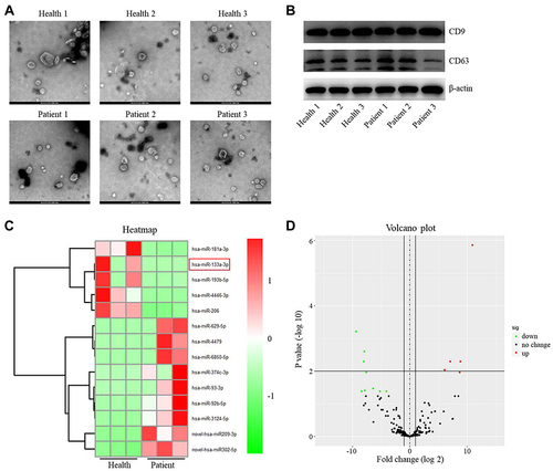 Figure 1 Differentially expressed miRNAs between exosomes derived from plasma of healthy people and patients with IS. (A) The extracellular vesicles were extracted from the plasma of patients with IS (n=3) or healthy people (n=3). Then, the extracellular vesicles were identified by TEM. (B) The expressions of CD9 and CD63 in extracellular vesicles from healthy people and patients with IS were detected by Western blot. (C) The differentially expressed miRNAs between the exosomes from healthy people and patients with IS were assessed using heatmap. (D) Volcano plots illustrating the differentially expressed miRNAs in IS. Red indicates a higher expression level, while green indicates a lower expression level.