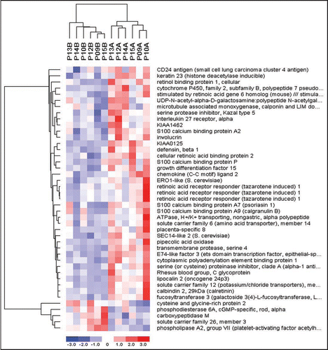 Figure 3 One week Clustering Diagram. Hierarchical clustering was used to compute a dendogram that assembled all samples and genes into a single tree. Normalized gene array expression data from each patient’s baseline and treatment biopsy was imported into dChip software version 1.3. Each row represents a single gene and each column represents a patient sample. B = baseline and A = after treatment. The color reflects the level of expression when compared to the mean level of expression for the entire 1 week biopsy set.