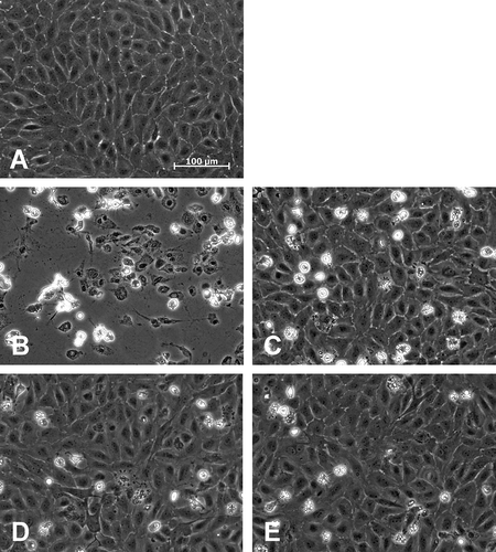 FIGURE 2. Monolayer integrity after 3 h re-culture.Porcine aortic endothelial cell monolayers (control, A) were cryopreserved (−0.1°C/min) in cell culture medium (M 199; B), solution 1 (chloride-rich; C), solution 2 (chloride-poor, balanced Na+/K+ concentrations; D) or solution 3 (chloride-poor, potassium-rich; E), all supplemented with 10% DMSO. Phase contrast micrographs (original magnification: 200x) were taken after 3 h of re-culture in cell culture medium.