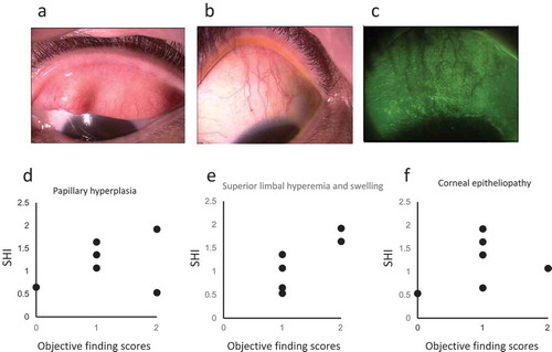 Figure 1. Anterior photographs of a representative patient and the relationship between the clinical scores and superior hyperemia index (SHI).a, b, and c: Slit-lamp photographs of the patient with superior limbic keratoconjunctivitis show that the patient’s eye scores one point each for papillary formation of the superior palpebral conjunctiva, superior limbal swelling and hyperemia, and superior corneal epitheliopathy.d, e, and f: Relationship between the SHI and papillary formation of the superior palpebral conjunctiva (d), superior limbal hyperemia (e) and swelling, and superior corneal epitheliopathy (f). The SHI shows a tendency to indicate the severity of the superior limbal hyperemia and swelling score.