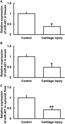 Figure 4. Relative expression of miR-421 in cartilage tissues (A), serum (B) and synovial fluid (C) from patients with cartilage injury of elbow joint of upper limbs. Note: qRT-PCR was used to determine the expression of miR-421. U6 was used as internal reference, and expression of target gene in each group was divided by that of U6. Then, the value of experimental group was normalized to control group. *p < 0.05 and **p < 0.01 compared with control group.