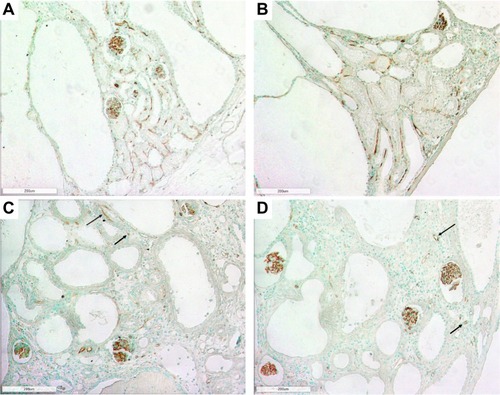 Figure 2 Photomicrographs of the renal cortex in LPK rats using RECA-1 immunostaining showing extensive peritubular capillary loss with cyst expansion and sporadic vessel formation in renal cortex. (A) Week 3 (100x); (B) Week 6 (100x); (C) Week 12 (100x) and (D) Week 24 (100x). Examples of sporadic vessels are indicated by arrows.