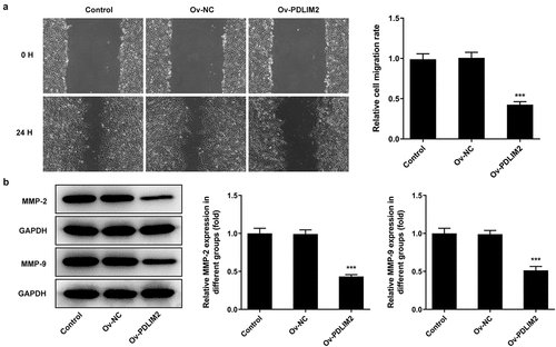 Figure 2. Overexpression of PDLIM2 inhibited the migration of HFLSs-RA. A. Wound healing was used to detect the migration of HFLSs-RA. B.T he expression of MMP-2 and MMP-9 in HFLSs-RA after transfection were detected by western blot. ***p < 0.001 vs Ov-NC.