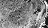 FIG. 12 SEM of the inner surface of the parietal basement membrane of a cyst after removal of all cells by NaOH digestion. Note irregular bundles of collagen and the opening into proximal tubule (arrow). Bar = 100 μm.