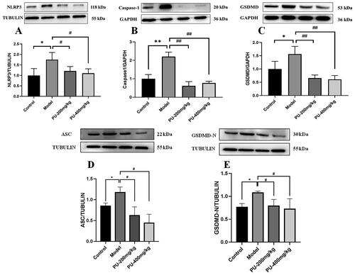 Figure 7. LGZGD downregulated the protein expression of NLRP3, caspase-1, GSDMD, ASC, and GSDMD-N. (A) NLRP3; (B) caspase-1; (C) GSDMD; (D) ASC; (E) GSDMD-N. The values were expressed as the mean ± SD (n = 3); *p < 0.05; **p < 0.01 vs. control group; #p < 0.05; ##p < 0.01 vs. model group.