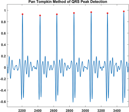 Figure 6. QRS detection using Pan Tompkin’s Method.