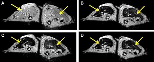 Figure 9 T2-weighted magnetic resonance images of rat livers (A) before injection, (B) 10 minutes after injection, (C) 20 minutes after injection, (D) 30 minutes after injection of the cold SPION suspension.Note: The arrows point to the liver.Abbreviation: SPION, superparamagnetic iron oxide nanoparticle.