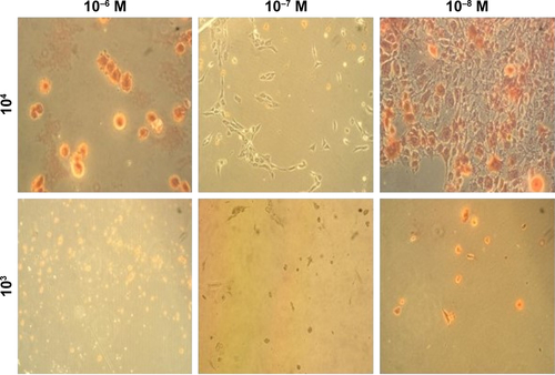 Figure S3 Optical images of MC3T3-E1 mineralization section in different osteoinductive conditions for 7 days (×100).Notes: 103, 104: cell seeding density; 10−6, 10−7, 10−8: dexamethasone concentration.