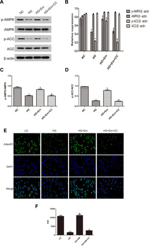 Figure 4 (A) Protein expression analysis of p-AMPK, AMPK, p-ACC and ACC in low-glucose HK-2 cells (NC), high-glucose HK-2 cells (HG), high-glucose plus empagliflozin-treated HK-2 cells (HG+Em), and high-glucose plus empagliflozin plus compound C HK-2 (HG+Em+CC) cells. (B) Histogram of p-AMPK, AMPK, p-ACC and ACC expression. (C and D) Histogram of the p-AMPK/AMPK and p-ACC/ACC ratios. (E) Representative images and of immunofluorescence staining for AdipoR1. All images are magnified 200x. (F) Cumulative optical density values for AdipoR1 *p<0.05 vs. NC; &p<0.05 vs. HG; #p<0.05 vs. HG+Em.