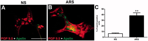 Figure 4. Whole‐mount preparations of distal colonic myenteric neurons obtained from NS (A) and ARS-loaded (B) rats. The quantitative analysis of PGP 9.5 (red)- and apelin (green)-immunoreactive cells (C) in myenteric neurons harvested from distal regions of colon in NS and ARS-loaded rats. Data are means ± SE. **p < .01 vs NS. NS: non-stressed, ARS: acute restraint stress for 90 min. The scale bars represent 200 µm, n = 4 in all groups.