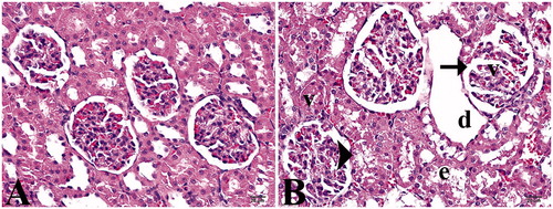 Figure 1. (A) Control group. (B) Study group: (d) tubular dilatation, (v) vacuolization, (e) epithelium desquamation, arrow head; cell degenerations, arrow; dilatation of Bowman’s capsule (Hematoxylin–eosin staining, 40×).